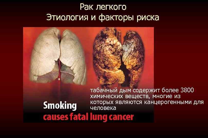 Рак легкого Этиология и факторы риска табачный дым содержит более 3800 химических веществ, многие