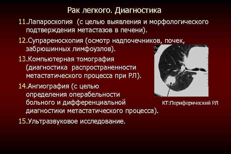 Рак легкого. Диагностика 11. Лапароскопия (с целью выявления и морфологического подтверждения метастазов в печени).