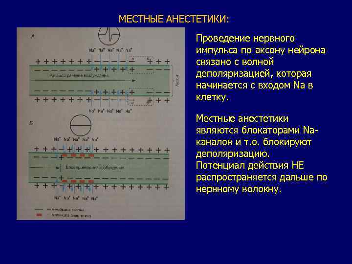 МЕСТНЫЕ АНЕСТЕТИКИ: Проведение нервного импульса по аксону нейрона связано с волной деполяризацией, которая начинается