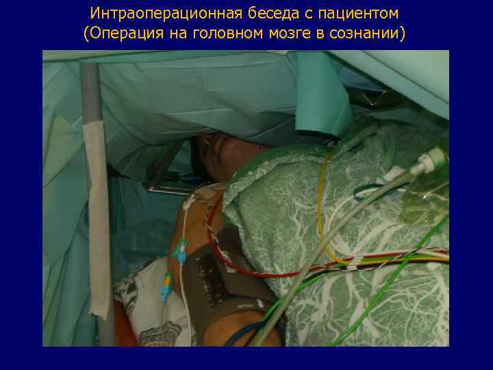 Интраоперационная беседа с пациентом (Операция на головном мозге в сознании) 
