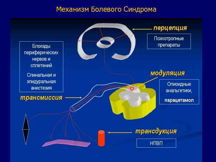 Механизм Болевого Синдрома 