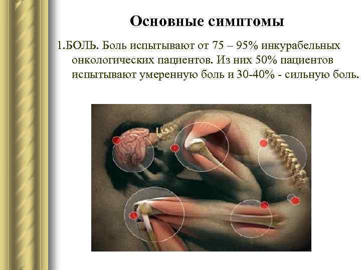 Основные симптомы 1. БОЛЬ. Боль испытывают от 75 – 95% инкурабельных онкологических пациентов. Из