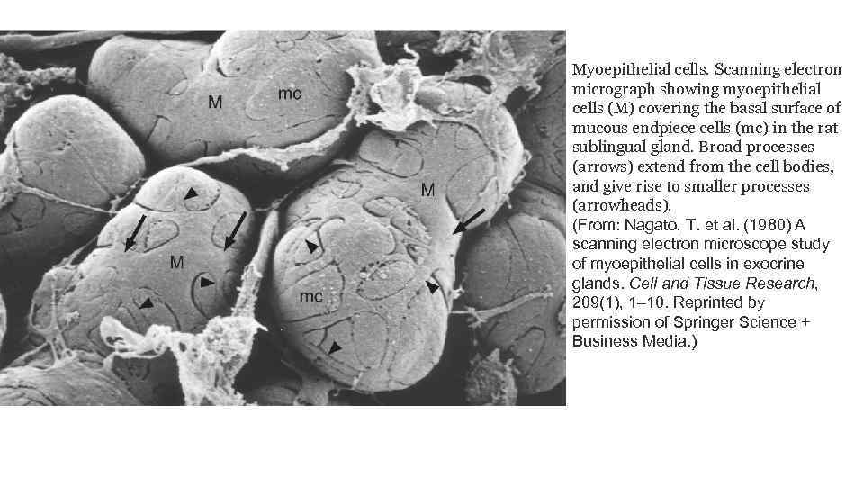 Myoepithelial cells. Scanning electron micrograph showing myoepithelial cells (M) covering the basal surface of