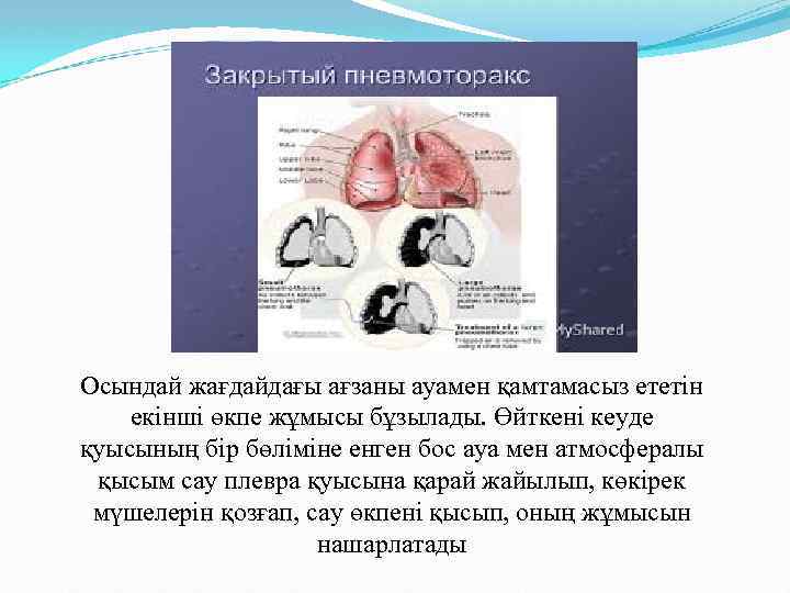 Осындай жағдайдағы ағзаны ауамен қамтамасыз ететін екінші өкпе жұмысы бұзылады. Өйткені кеуде қуысының бір