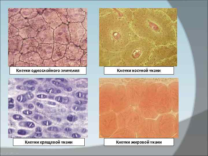 Клетки однослойного эпителия Клетки костной ткани Клетки хрящевой ткани Клетки жировой ткани 