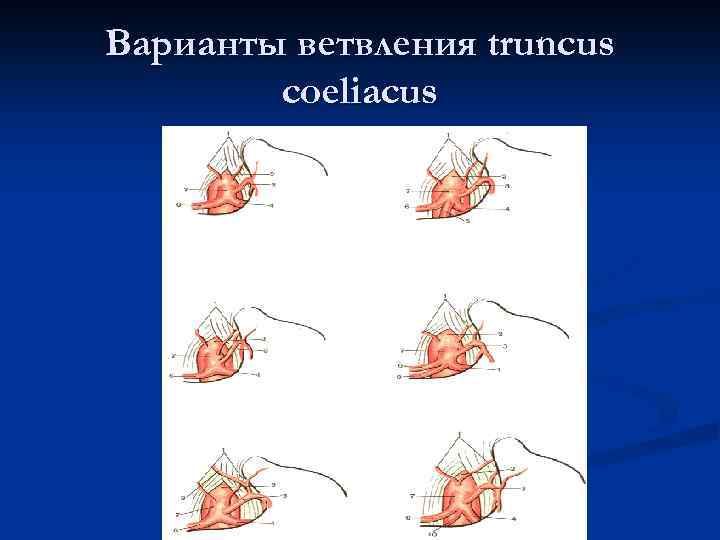 Варианты ветвления truncus coeliacus 