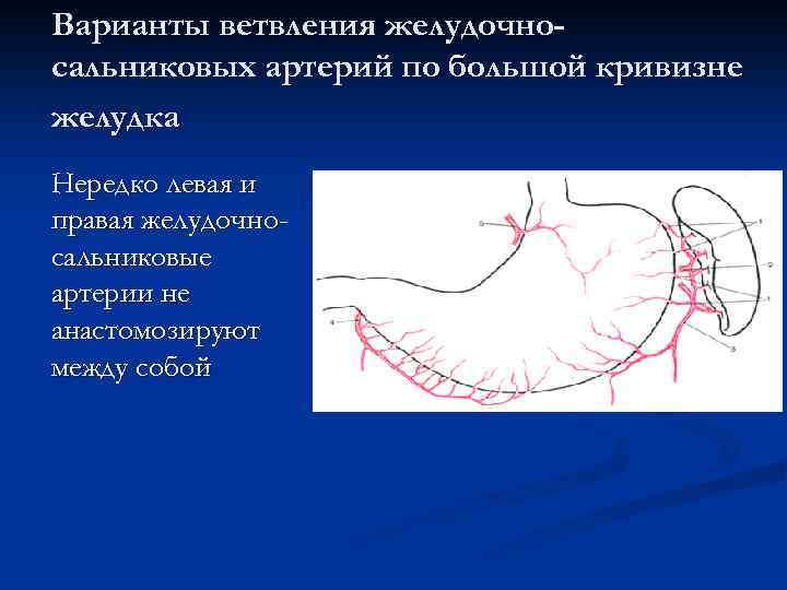 Варианты ветвления желудочносальниковых артерий по большой кривизне желудка Нередко левая и правая желудочносальниковые артерии