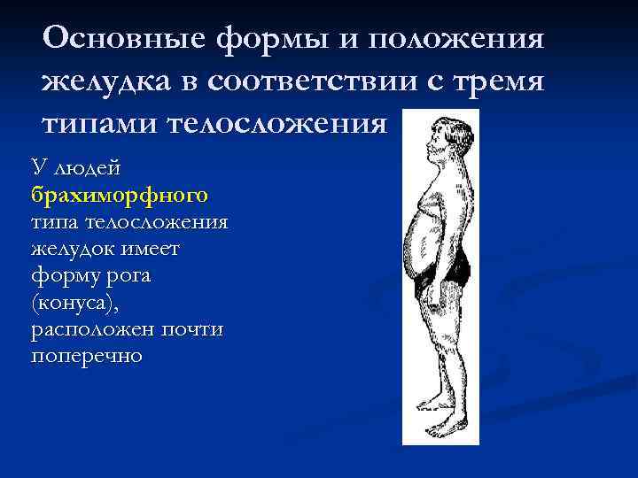 Основные формы и положения желудка в соответствии с тремя типами телосложения У людей брахиморфного