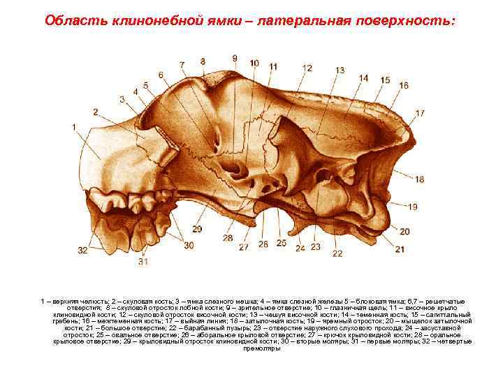 Область клинонебной ямки – латеральная поверхность: 1 – верхняя челюсть; 2 – скуловая кость;