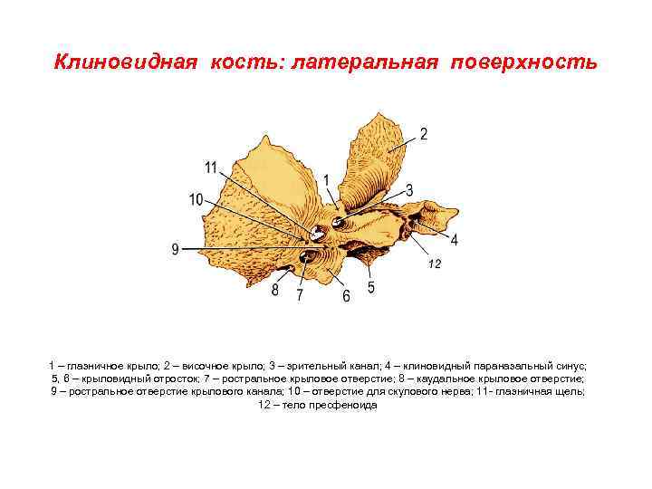 Клиновидная кость: латеральная поверхность 1 – глазничное крыло; 2 – височное крыло; 3 –