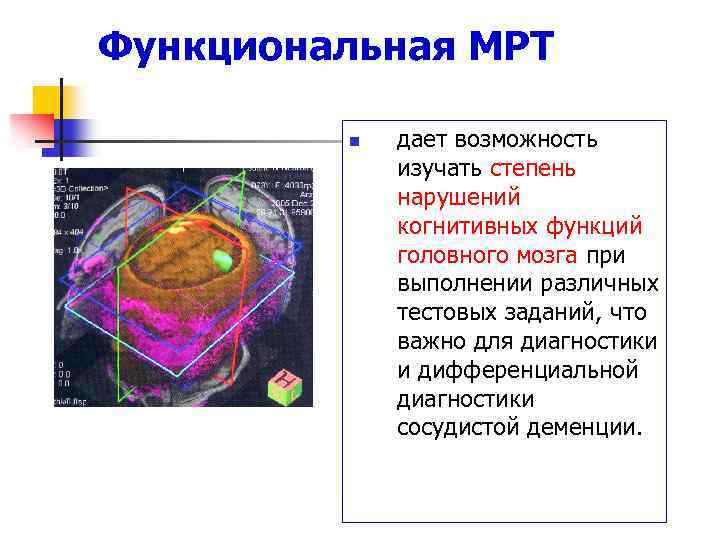 Функциональная МРТ n дает возможность изучать степень нарушений когнитивных функций головного мозга при выполнении