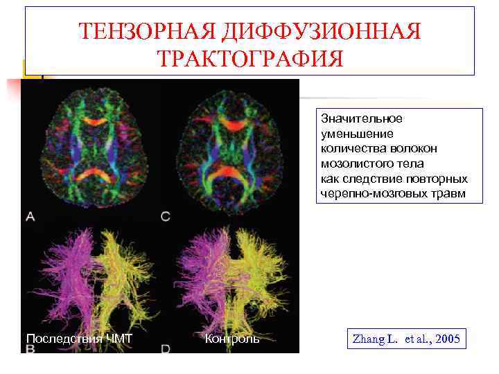 Диффузионно взвешенное изображение