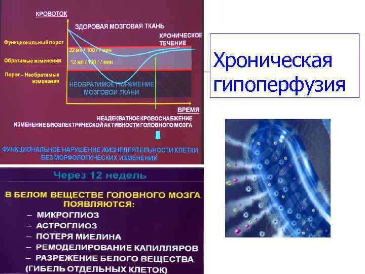 Хроническая гипоперфузия 