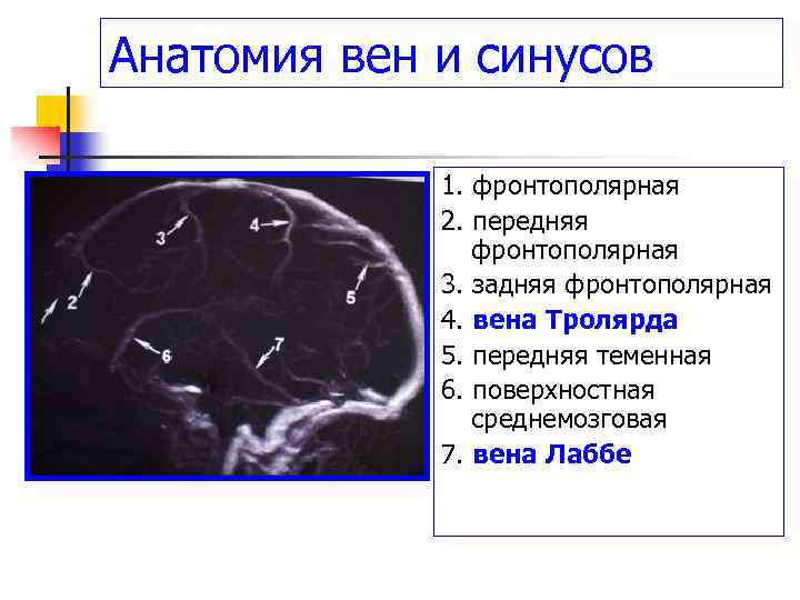 Анатомия вен и синусов 1. фронтополярная 2. передняя фронтополярная 3. задняя фронтополярная 4. вена