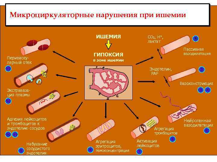 Микроциркуляторные нарушения при ишемии ИШЕМИЯ CO 2, H+, лактат 1 Пассивная вазодилатация ГИПОКСИЯ Периваскулярный