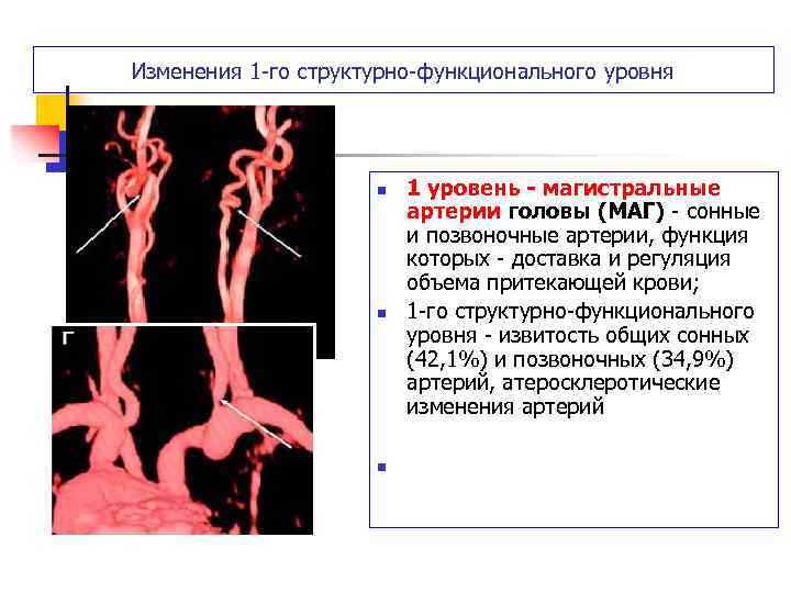 Магистральные сосуды. Патология сонных и позвоночных артерий. Магистральные сосуды головы. Сонная Магистральная артерия. Переплетение сонных артерий.