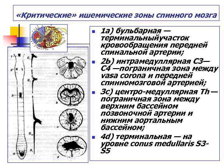  «Критические» ишемические зоны спинного мозга n n 1 а) бульбарная — терминальныйучасток кровообращения