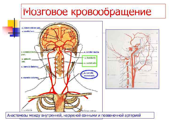 Вертебро базилярная недостаточность на фоне шейного