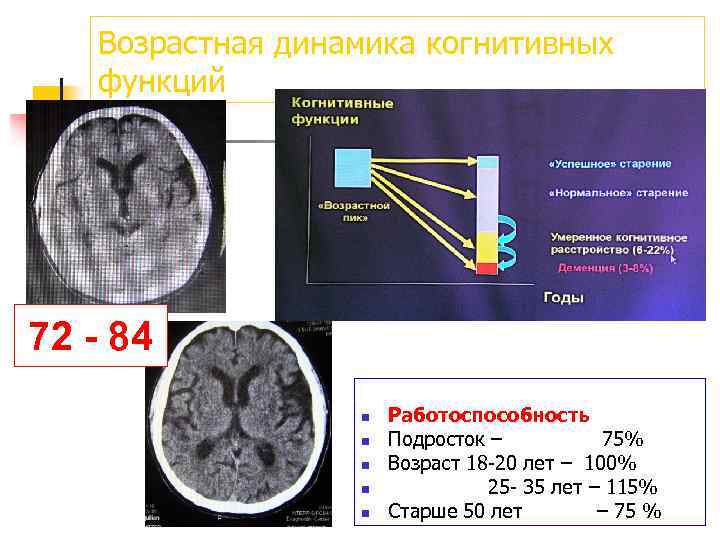 Возрастная динамика когнитивных функций 72 - 84 n n n Работоспособность Подросток – 75%