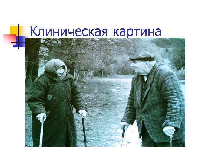 Клиническая картина 