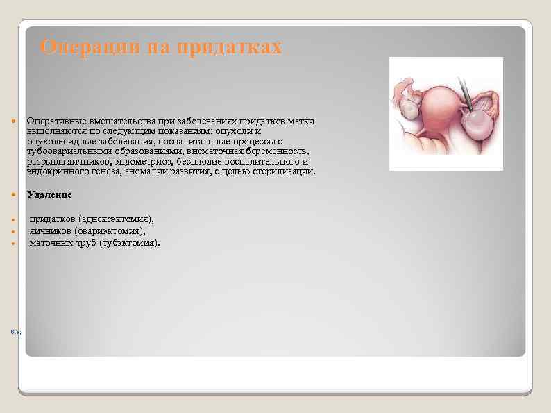 Операции на придатках Оперативные вмешательства при заболеваниях придатков матки выполняются по следующим показаниям: опухоли