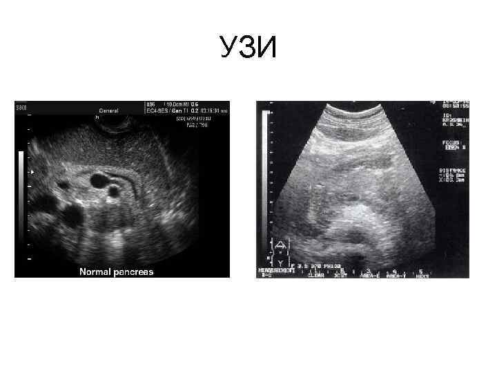 УЗИ 