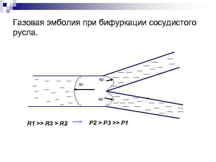 Газовая эмболия при бифуркации сосудистого русла. R 2 R 1 R 3 R 1
