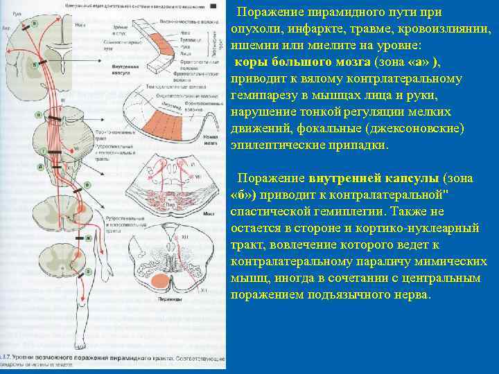 Поражение двигательного анализатора на различных уровнях поражения схема