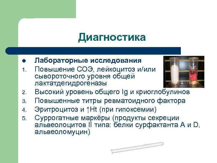 Диагностика l 1. 2. 3. 4. 5. Лабораторные исследования Повышение СОЭ, лейкоцитоз и/или сывороточного