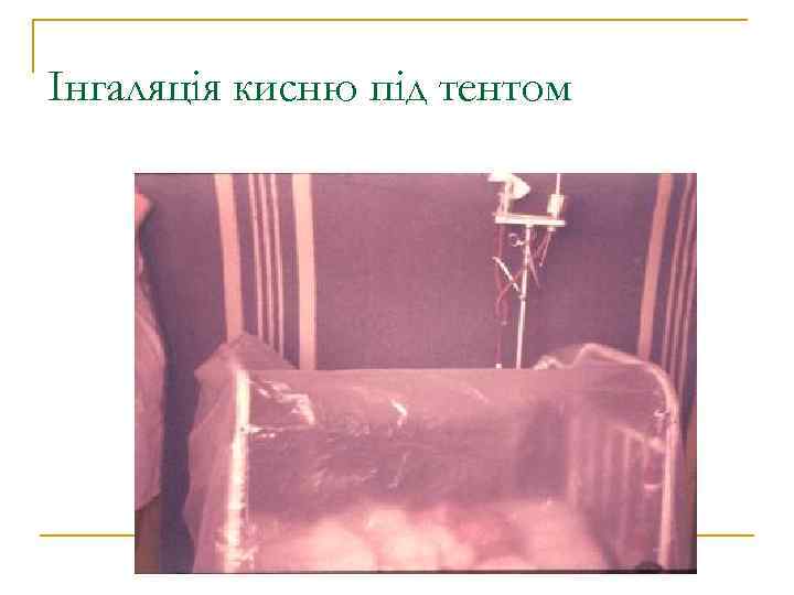 Інгаляція кисню під тентом 