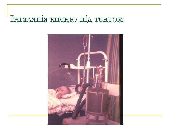 Інгаляція кисню під тентом 