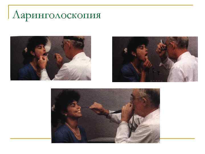 Ларинголоскопия 