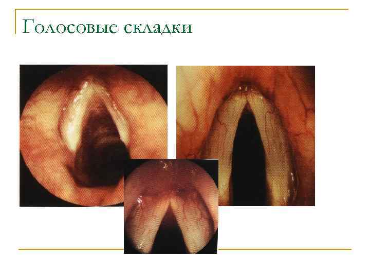 Голосовые складки 