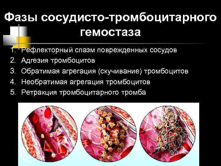 Фазы сосудисто-тромбоцитарного гемостаза 1. 2. 3. 4. 5. Рефлекторный спазм поврежденных сосудов Адгезия тромбоцитов