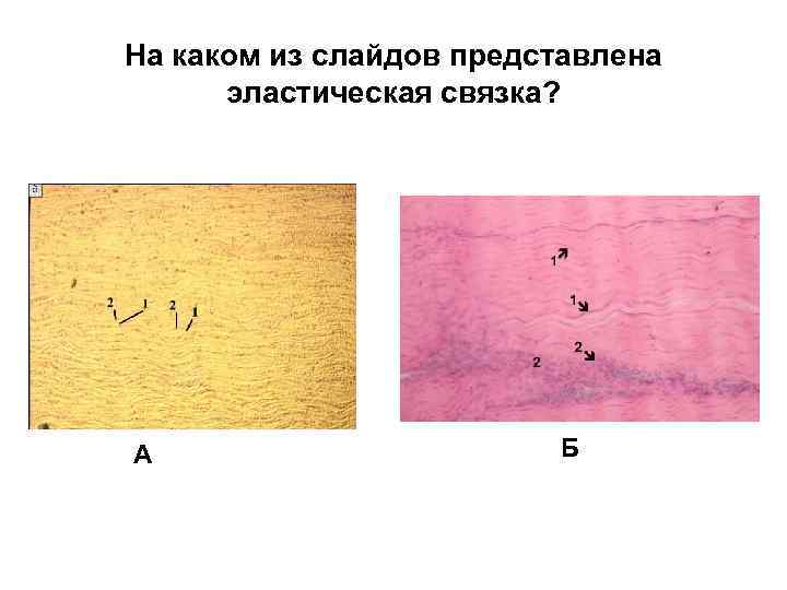 На каком из слайдов представлена эластическая связка? А Б 