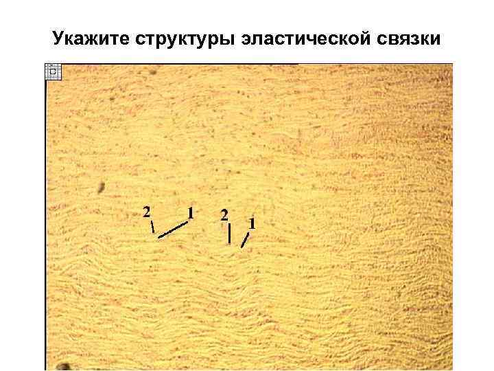 Укажите структуры эластической связки 