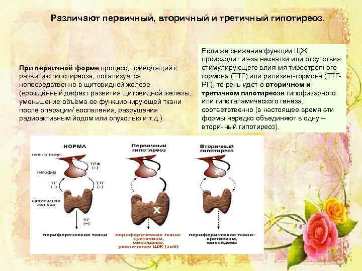 Различают первичный, вторичный и третичный гипотиреоз. При первичной форме процесс, приводящий к развитию гипотиреоза,