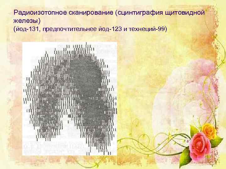Радиоизотопное сканирование (сцинтиграфия щитовидной железы) (йод-131, предпочтительнее йод-123 и технеций-99) 