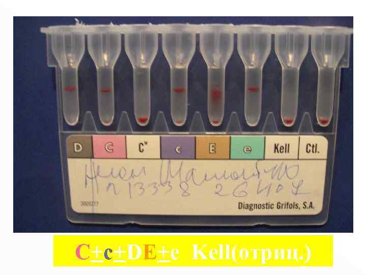 С+с+DE+e Kell(отриц. ) 