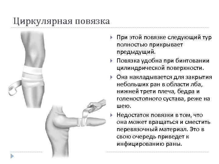 Циркулярная повязка При этой повязке следующий тур полностью прикрывает предыдущий. Повязка удобна при бинтовании