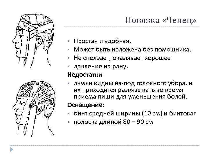  Повязка «Чепец» • Простая и удобная. • Может быть наложена без помощника. •