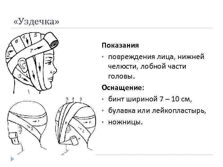  «Уздечка» Показания • повреждения лица, нижней челюсти, лобной части головы. Оснащение: • бинт