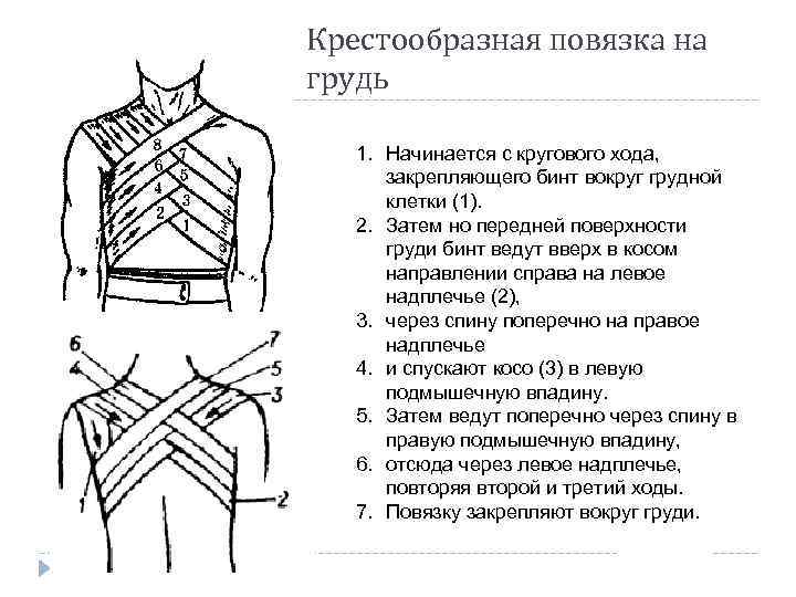 Крестообразная повязка на грудь 1. Начинается с кругового хода, закрепляющего бинт вокруг грудной клетки