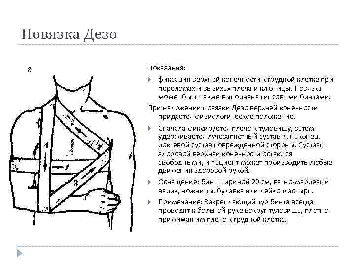 Повязка Дезо Показания: фиксация верхней конечности к грудной клетке при переломах и вывихах плеча