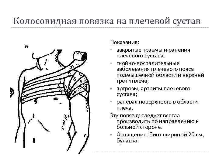 Колосовидная повязка на плечевой сустав Показания: • закрытые травмы и ранения плечевого сустава; •