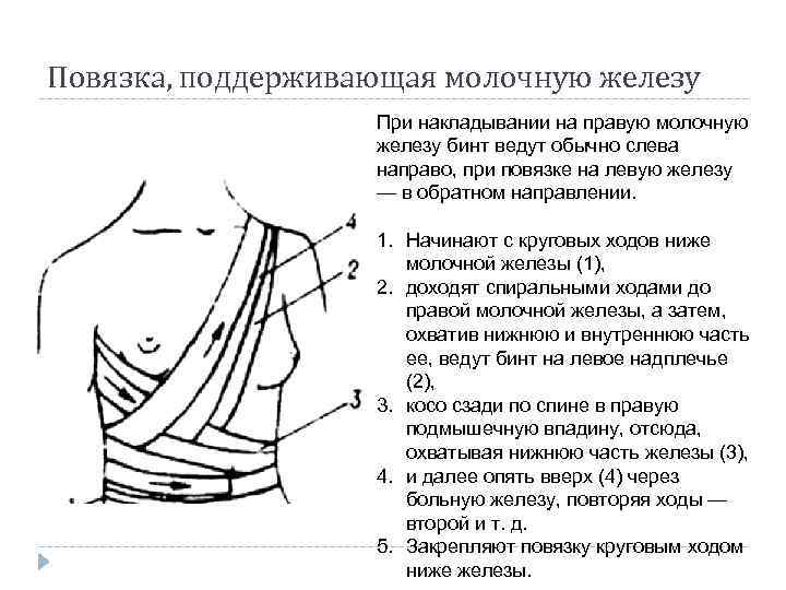 Повязка, поддерживающая молочную железу При накладывании на правую молочную железу бинт ведут обычно слева