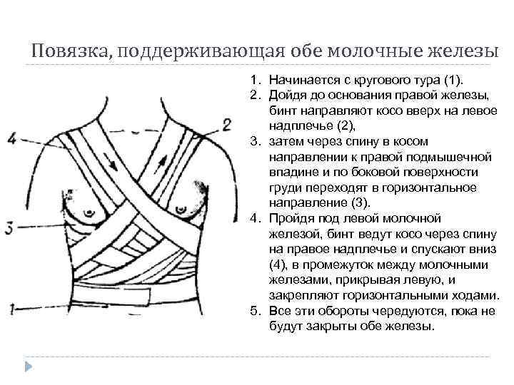 Повязка, поддерживающая обе молочные железы 1. Начинается с кругового тура (1). 2. Дойдя до