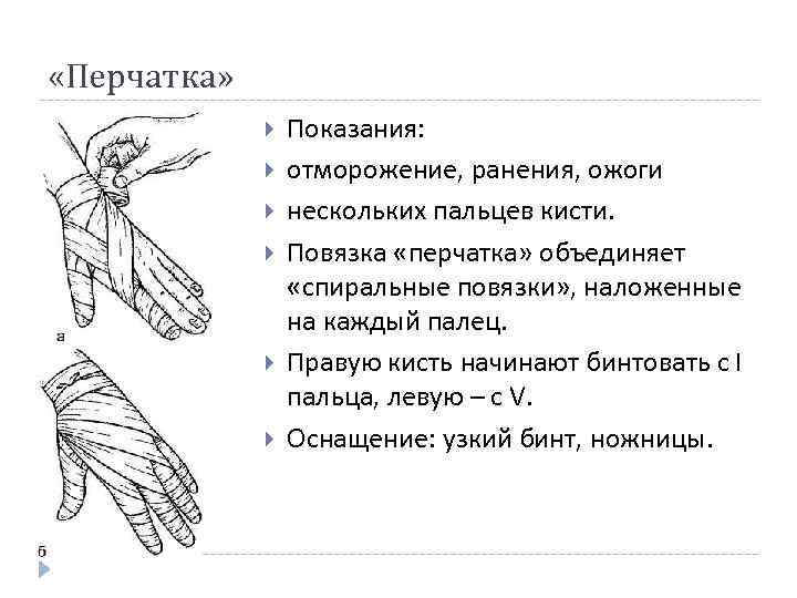  «Перчатка» Показания: отморожение, ранения, ожоги нескольких пальцев кисти. Повязка «перчатка» объединяет «спиральные повязки»