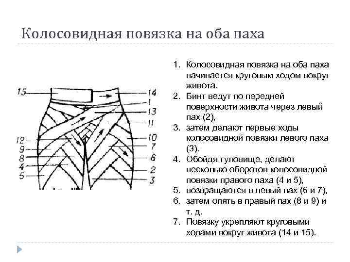 Колосовидная повязка на оба паха 1. Колосовидная повязка на оба паха начинается круговым ходом