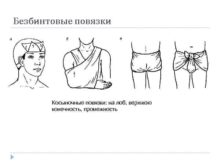 Безбинтовые повязки Косыночные повязки: на лоб, верхнюю конечность, промежность 